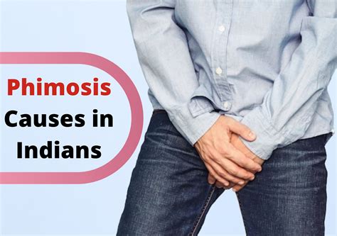 Phimosis: Causes, Symptoms, Diagnosis & Treatment